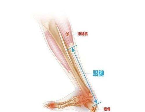 什么是跟腱断裂普通人也应该了解一下