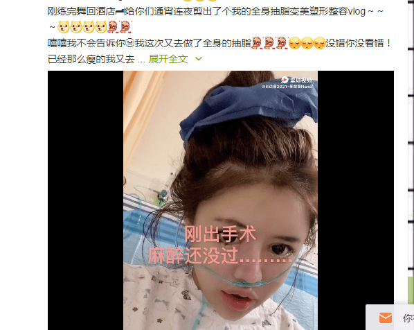 过往|整容200多次的网红曝辛酸过往：在幼儿园就受歧视，还被叫黑婆