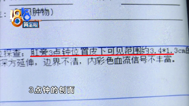 肛瘘术后来例假怎么办