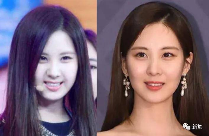 徐贤|从小土妹逆袭成神颜财阀公主，这位爱豆的换头思路请反复朗诵800遍！