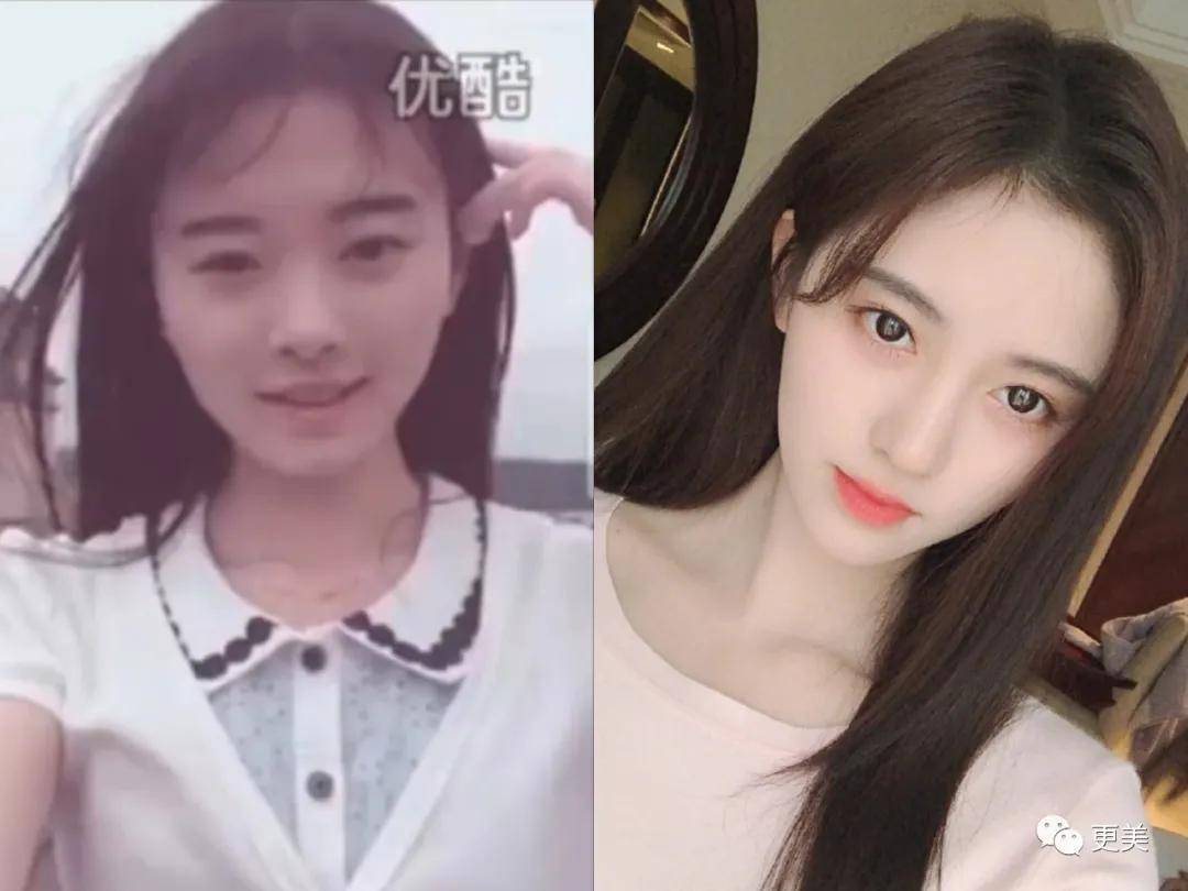 刘海|当毛发都在伪造的鞠婧祎失去刘海，场面瞬间窒息！