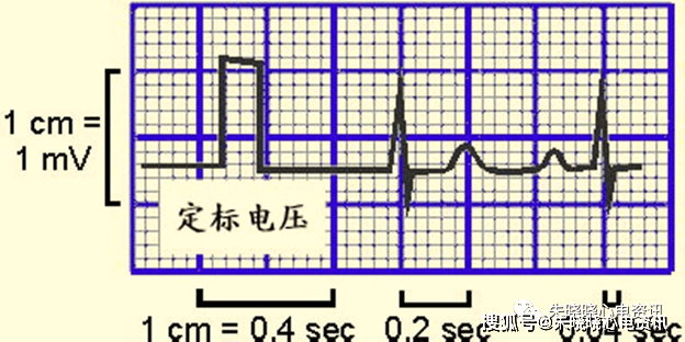 心电图是被记录在布满大小方格的纸上,所以想要知道心电图怎么看,首要