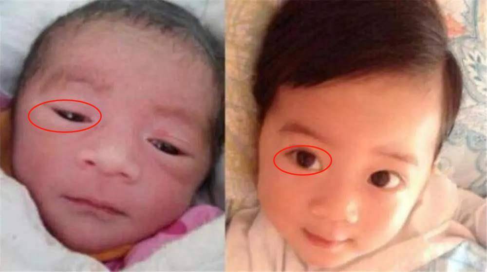 地方|娃这几个地方越丑长大越好看小时候丑长大就会好看？别着急反驳