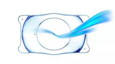 激光近视手术度数范围 e63ec3f46afd48949642ac77ea87f859.jpeg