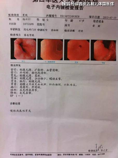 患者12: 赵** 疗前胃镜为"慢性萎缩性胃炎",疗后为"慢性胃炎伴糜烂"