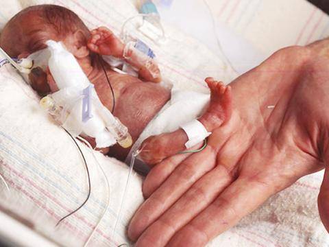 孩子|7孕龄早产宝宝“死而复生”？网友怒了：医院对“早产”有误读吧
