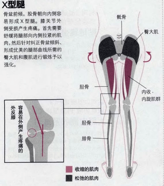 wildfieldhealth | 荒野健康:xo型腿如何靠按摩或锻炼