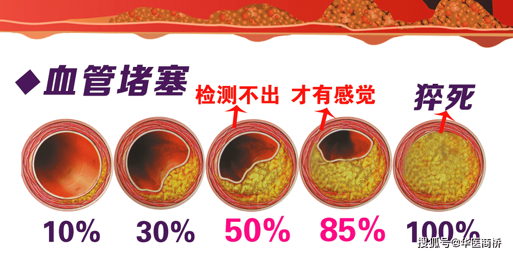 高血脂的症状和高血脂的调整方法