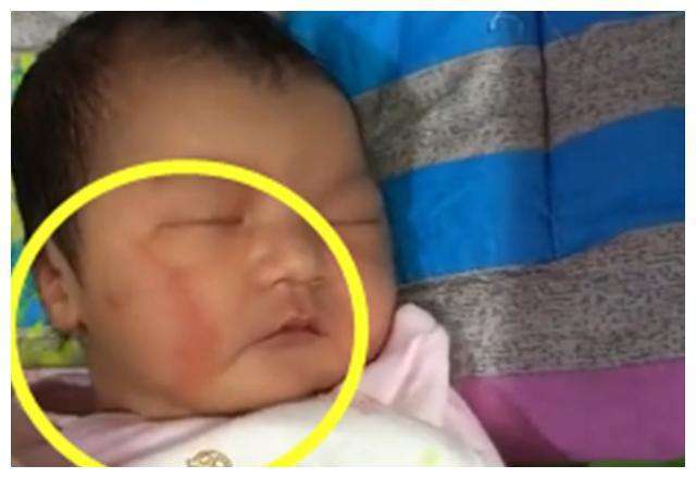 孩子|婆婆责儿媳没本事，心凉啊宝宝出生有“产钳印”