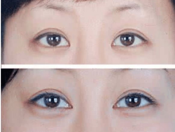 眼睛|2020年度爆红第一女星，脸上最成功的地方居然是双眼皮？