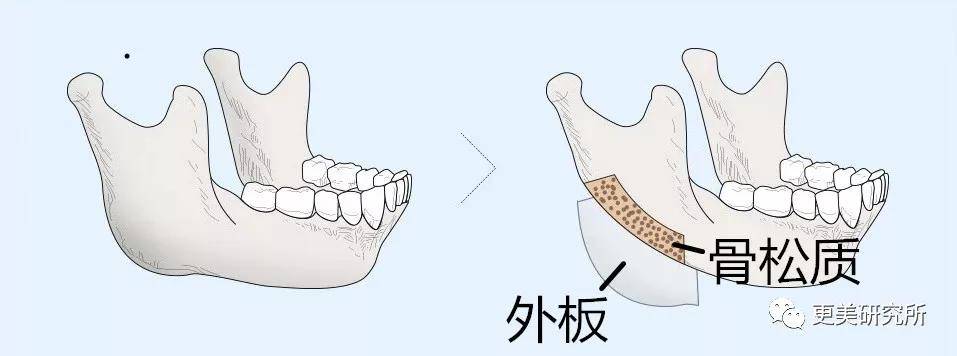 底子|骨相差生逆袭南韩第一时髦精，全智贤都压不住？！