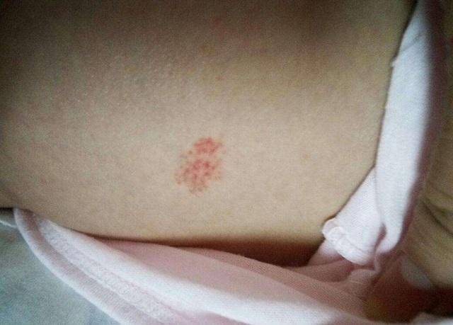 a198e2ee8ef541bca992b1f194f361af.jpeg