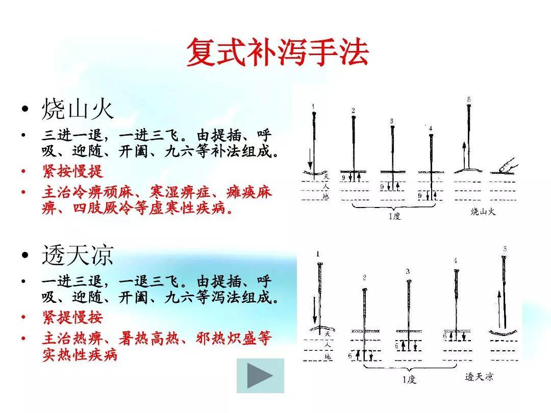 中医针灸流程表:持针,进针,行针,出针