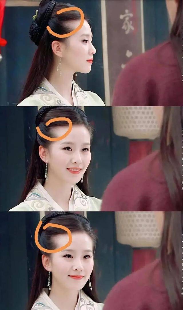 发际线|长得好看都难逃秃头？刘诗诗旧照被扒也秃头，跟杨幂鞠婧祎有一拼