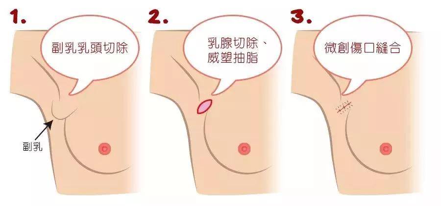 内衣|虞书欣暴露油腻肚腩没多久，这次竟然公开要求p副乳了，身材管理就这么难吗？