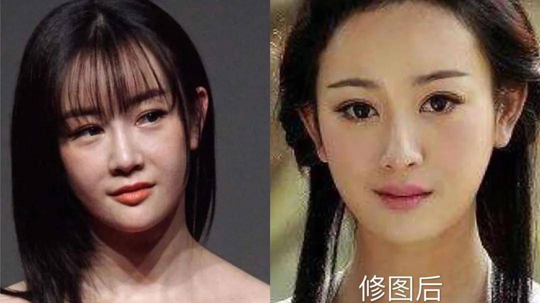 8分|3分到8分，为什么有人是天生适合整容脸?