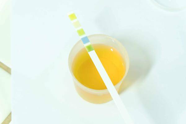 肾脏|上厕所时，尿液若呈现4个状态，或是尿毒症信号，千万别忽视！