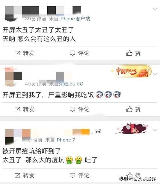 大片|易烊千玺频签国际代言，拍摄广告大片不遮瑕，脸上痘坑遭黑粉嫌丑