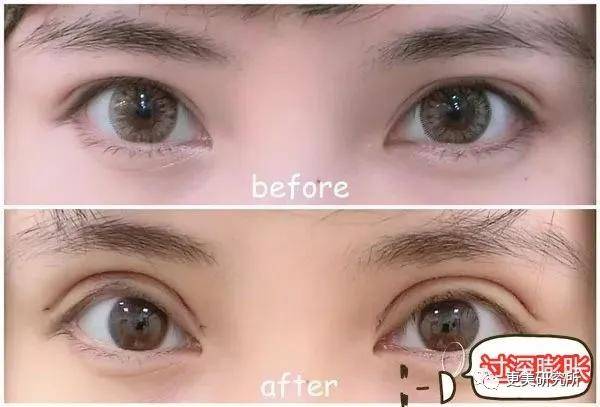 郭碧婷|比奚梦瑶、郭碧婷都惨的“豪门弃妇”，43岁颜值回春、好会do！