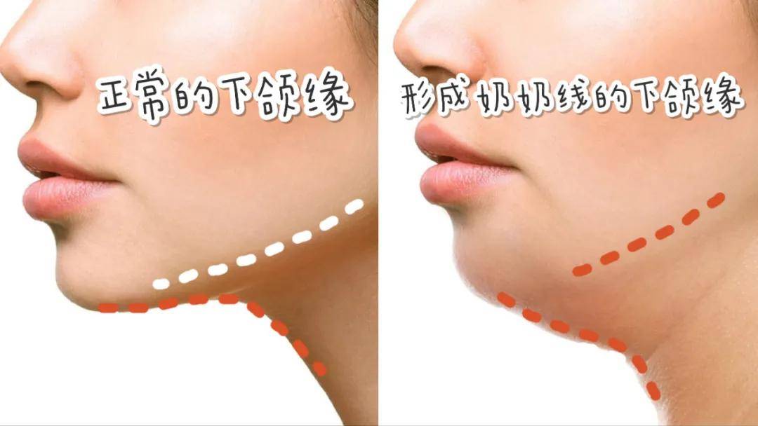 刘亦菲脸上竟然惊现“奶奶线”?天仙的完美骨相终究也难逃这一劫...