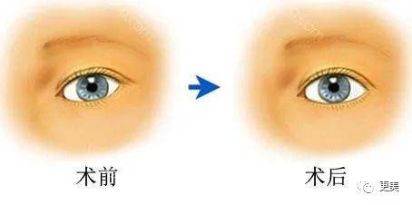 do|胖成球，眼睛do到快掉出眼眶，周杰伦最美“前女友”咋了...