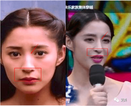 do|胖成球，眼睛do到快掉出眼眶，周杰伦最美“前女友”咋了...