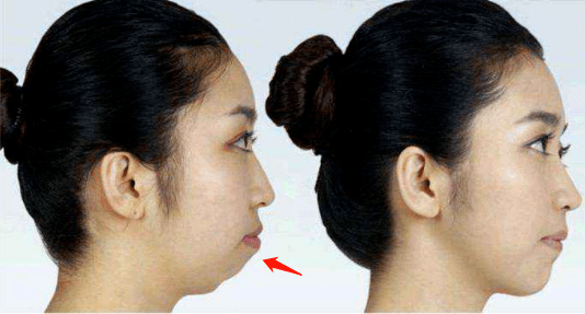 bd526301ed66471db520bf1e8a3af81a.png