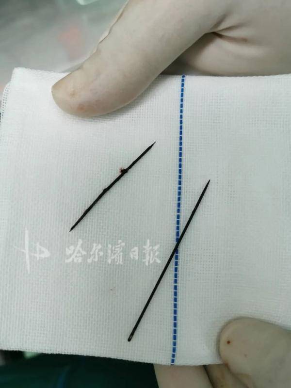 女生下面像针扎一样 是什么原理_女生下面宽是什么原因(3)