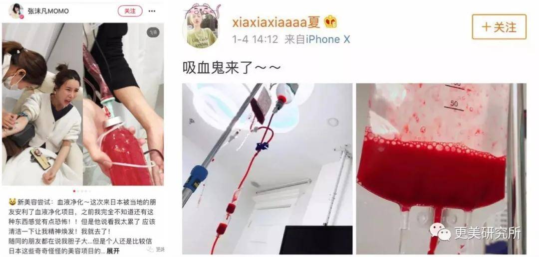 血液|赵薇婚变？44岁的她凭什么拿下亿万身家小鲜肉？！