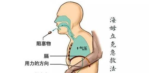 家长|家长别慌，试试这个方法，关键时间能救孩子孩子被东西卡到喉咙