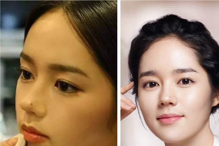 热巴|当红女星的“美人痣”，热巴长在眼下，韩佳人在鼻尖，谁最迷人？