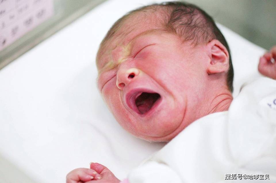 小黄人|没几天就变“小黄人”,是母乳质量不好吗?宝宝刚出生时粉嘟嘟