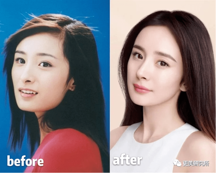 do|贵圈削骨图鉴 | 三代100个女星同时削掉半张脸、杨幂竟还垫底...