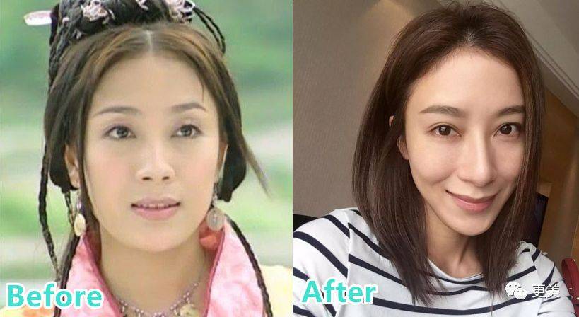 杨怡|曾经tvb一姐，演技一流，也把自己整僵了，假体太明显了...