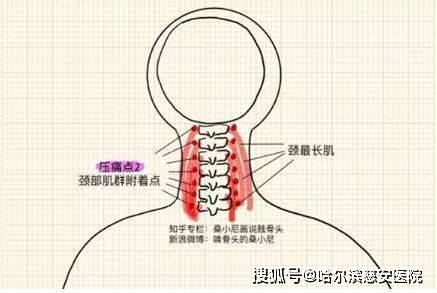 科普神经根型颈椎病