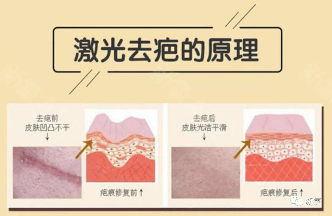 皮肤|16岁就上春晚的顶级流量，现在这脸怎么长残成这样了...
