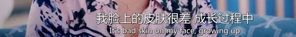 皮肤|16岁就上春晚的顶级流量，现在这脸怎么长残成这样了...