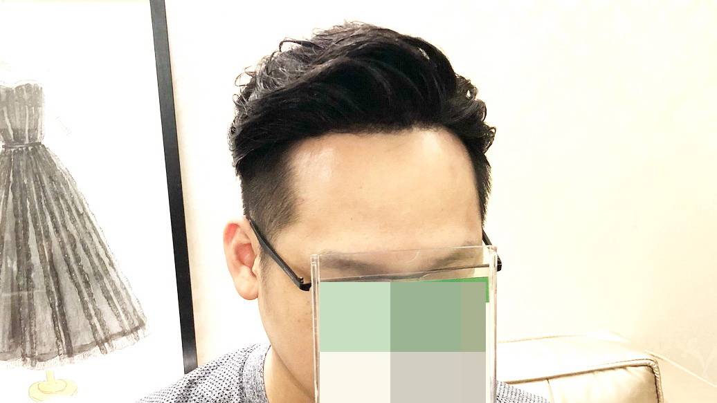 侧面照片怎么弄成正面 9943f4297e864c1691160bfd77c1bfc6.jpeg