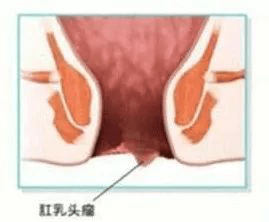 376898ec99a44d979a2dd50ac744a4b1.png