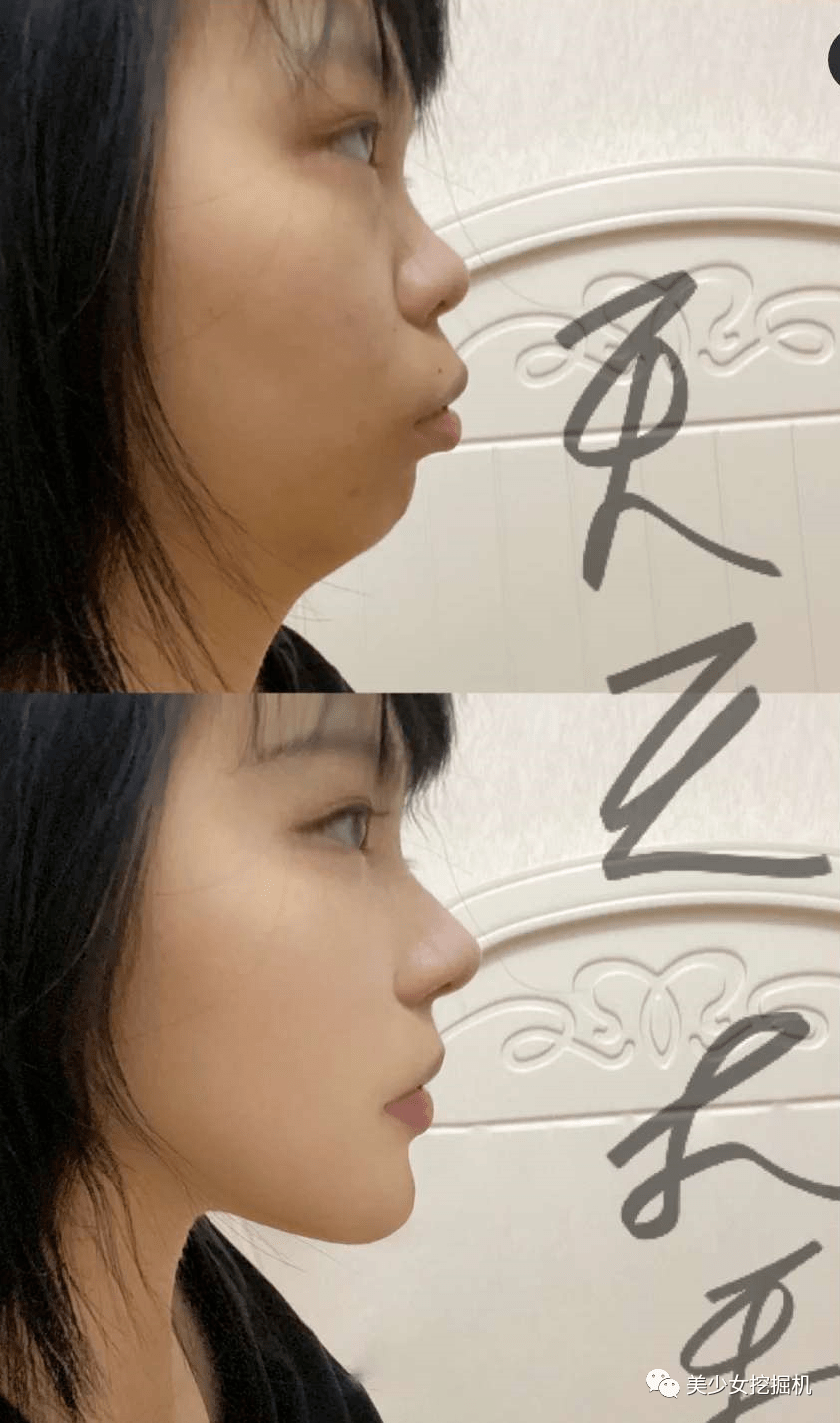 姐姐|整骨就能在辣妹和清纯茶艺妹之间无缝切换?亲妈都不认的假脸换头术太上头了···