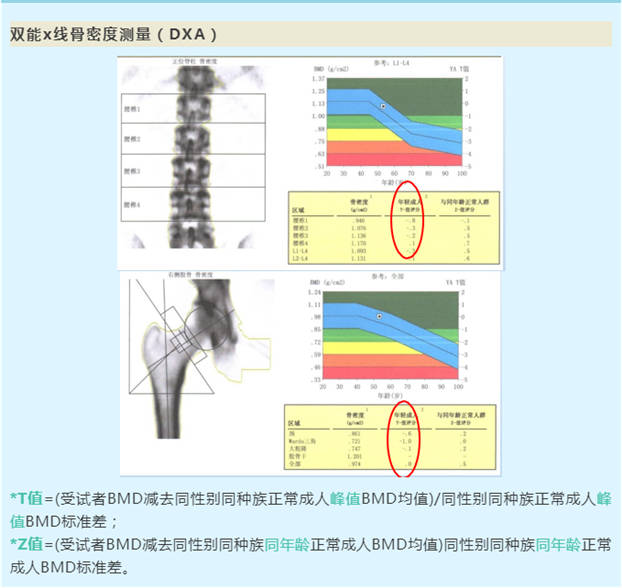 艳阳天|秋日艳阳天 健骨正当时——骨质疏松症的中医防治