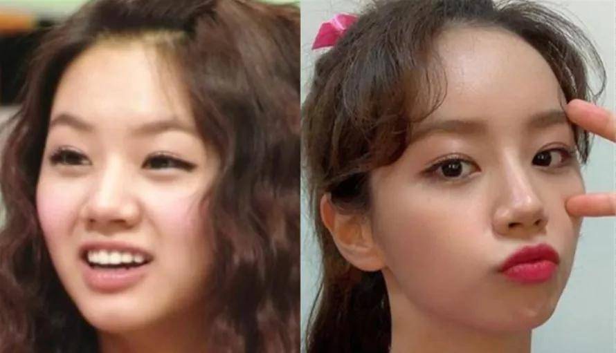 李惠利|女明星最绝大鼻头变身记！娜扎do鼻子前应该找她取经1000次...