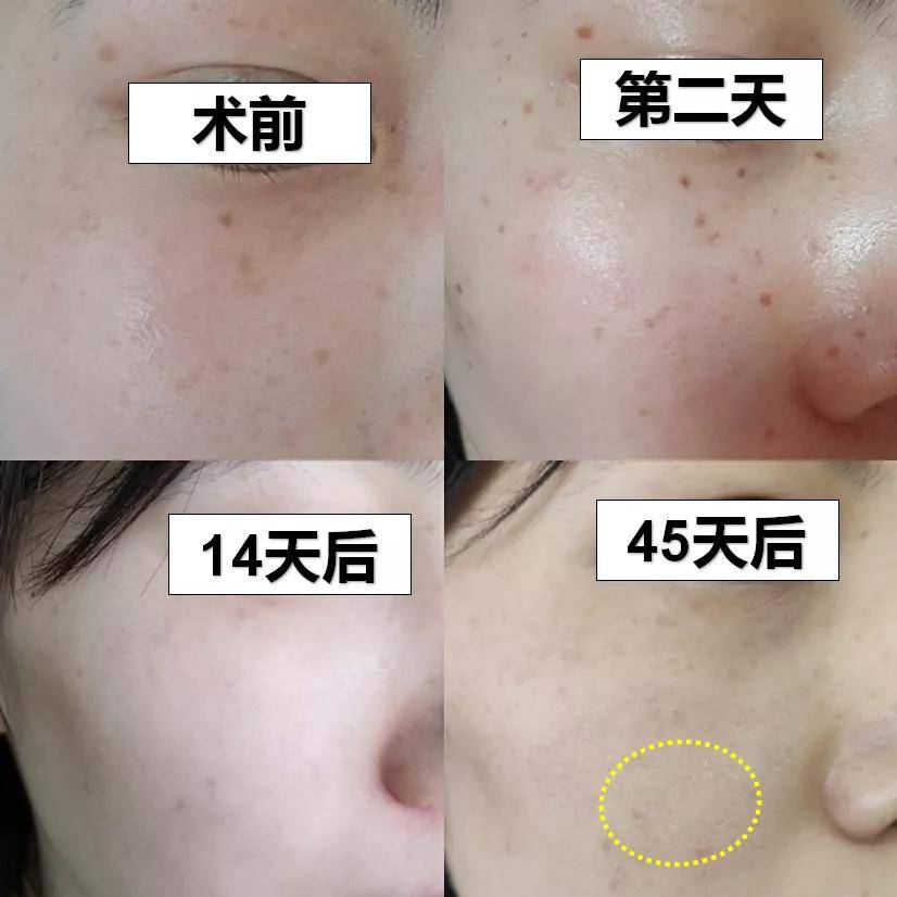 斑点|美到甘愿被她抢老公，王思聪新盯上的“女友”到底赢在哪？