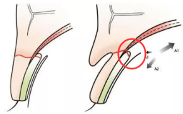 李惠利|女明星最绝大鼻头变身记！娜扎do鼻子前应该找她取经1000次...
