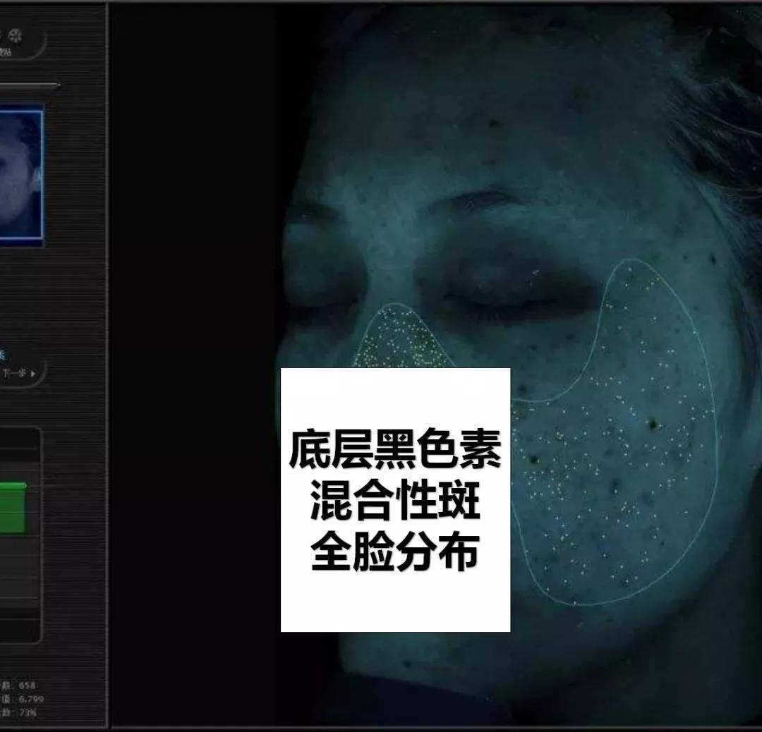 斑点|美到甘愿被她抢老公，王思聪新盯上的“女友”到底赢在哪？