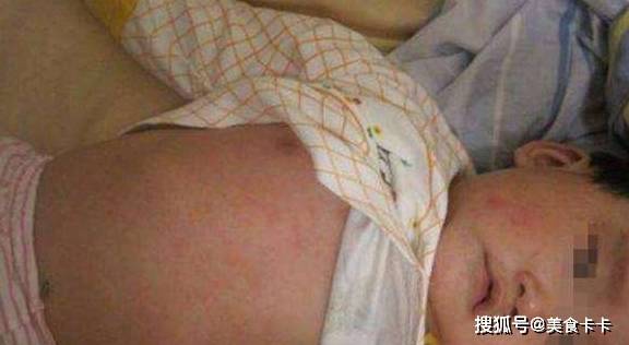 脸上长红点点是怎么回事怎么治 61a4a2f23ea5499e956b6b0aacd55ef1.jpeg