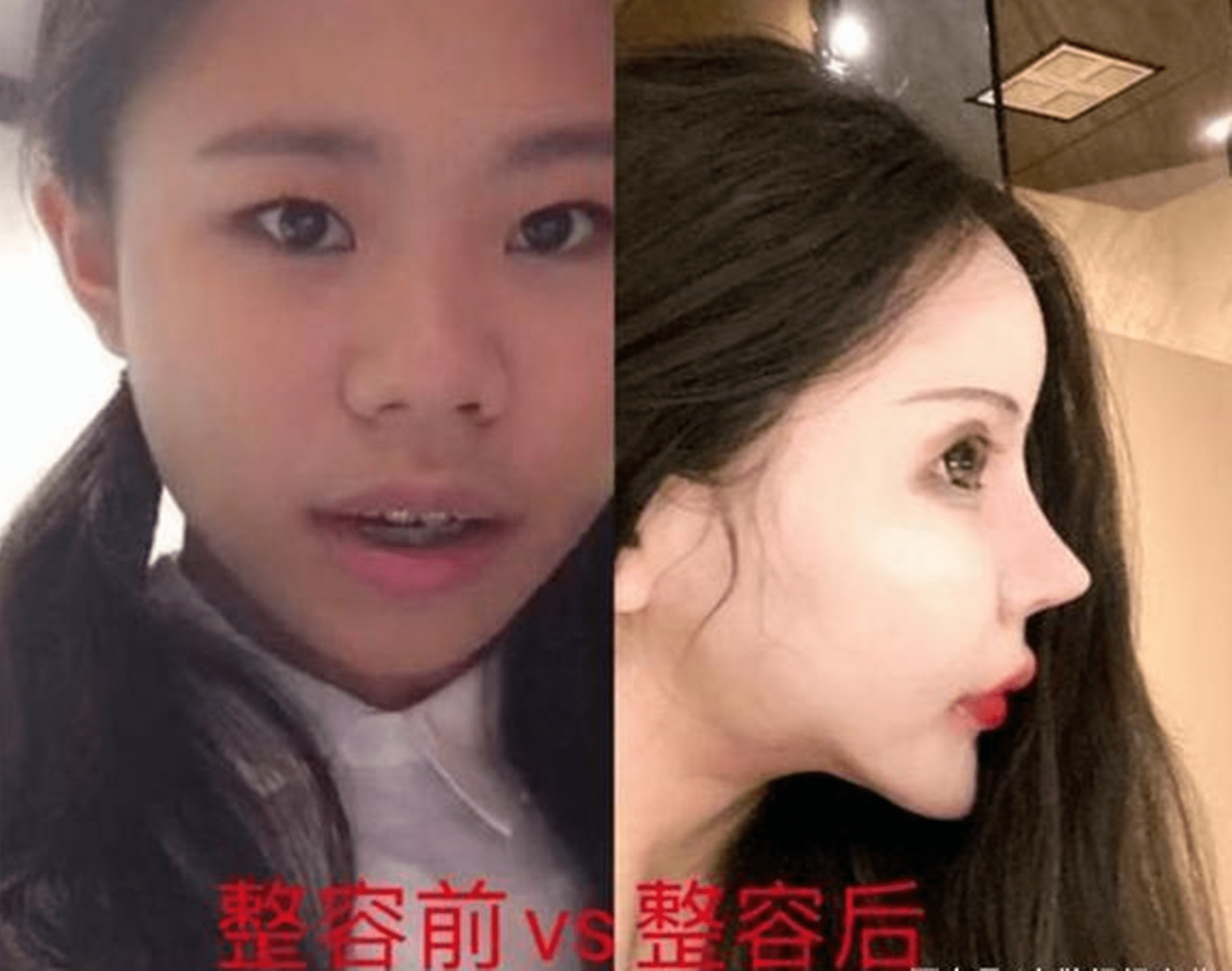 00后女孩3年整容100多次,妈妈却大力支持,对比照下评论"亮了"