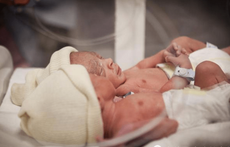 是什么原因引起早产 f424a2ca465846288bb9365180c4cd4f.png