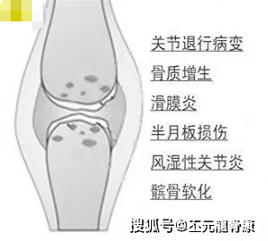 【丕元正骨柔筋】伤害膝关节的十种行为,您占了几个?