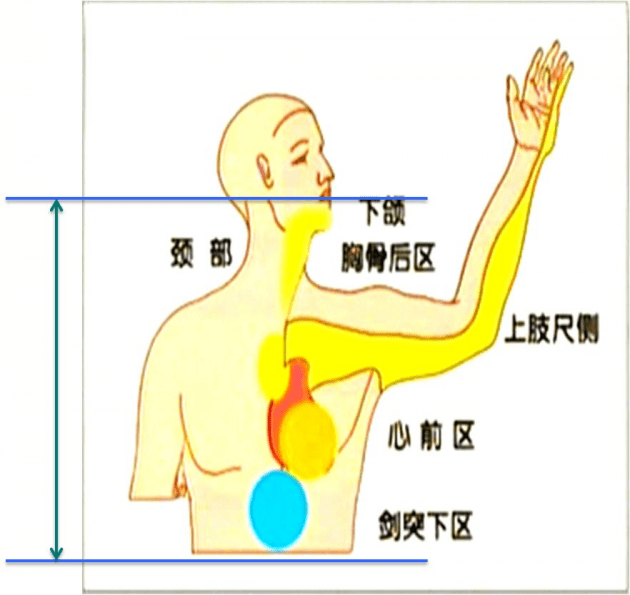 典型的心绞痛部位是在胸骨后或左前胸,范围常不局限,可以放射到颈部